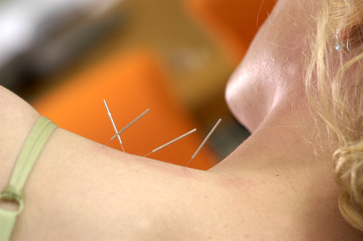 hooikoorts acupunctuur
